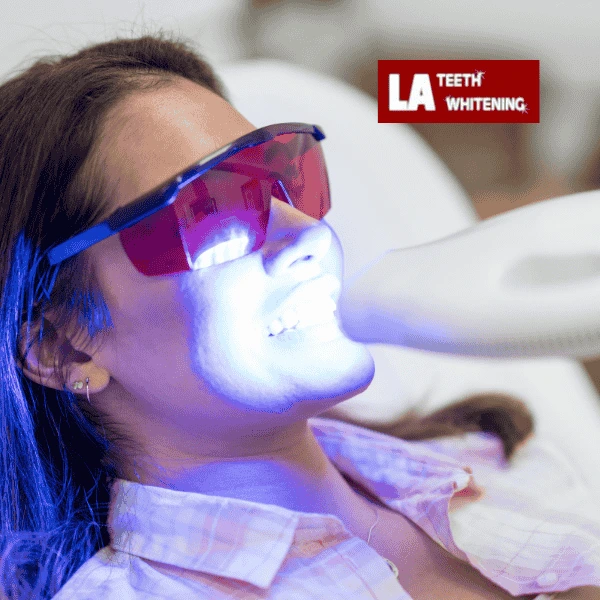 Contact LA Teeth Whitening Today! Book your appointment!Contact LA Teeth Whitening Today! Book your appointment! Rushden