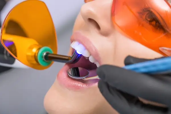 How Long Does Laser Teeth Whitening Last Rushden