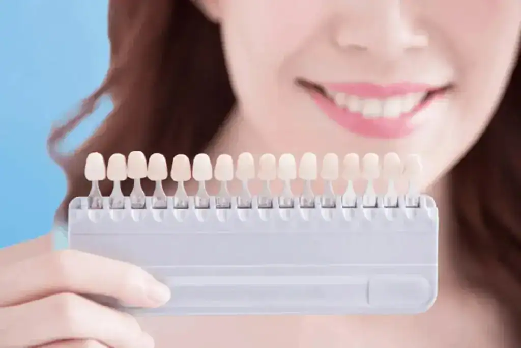 At-Home vs In-Clinic Whitening: Why Professional Laser Wins Rushden