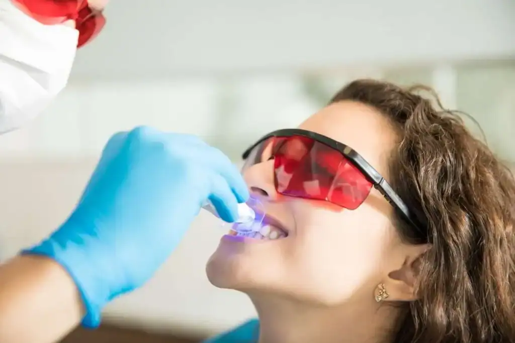 Laser Teeth Whitening FAQs Rushden &ndash; Your Ultimate Guide Rushden