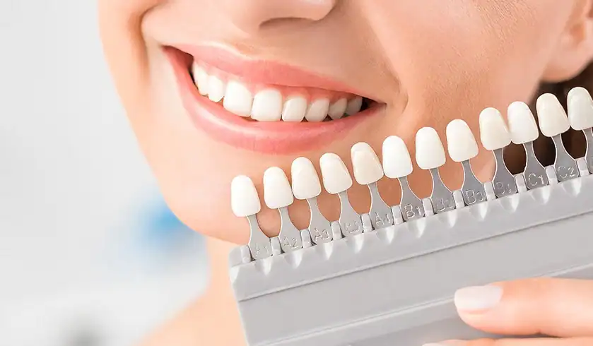 How Can You Tell When It’s Time for a Touch-Up Rushden